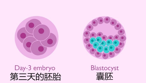 湛江试管婴儿