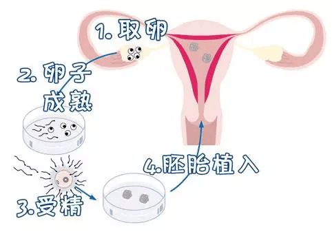 烟台捐卵费用