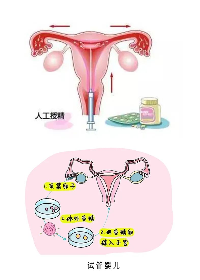 焦作捐卵志愿者