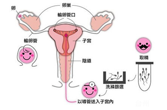 激素六项