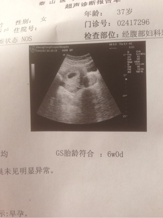 滨州中介捐卵子电话